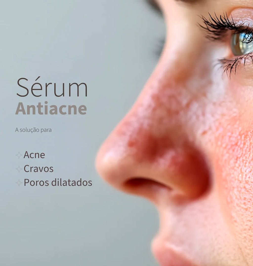 Sérum Antiacne e Controle de Cravos